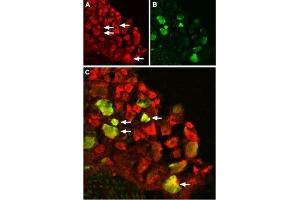 Expression of TRPV1 in rat DRGImmunohistochemical staining of rat dorsal root ganglion (DRG) using Anti-TRPV1 (VR1) Antibody (ABIN7043841, ABIN7043988 and ABIN7043989).