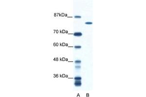 Western Blotting (WB) image for anti-DEAH (Asp-Glu-Ala-His) Box Polypeptide 16 (DHX16) antibody (ABIN2461579) (DHX16 Antikörper)