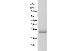 Western Blotting (WB) image for Frataxin (FXN) (AA 1-210) protein (His tag) (ABIN7123003) (Frataxin Protein (FXN) (AA 1-210) (His tag))