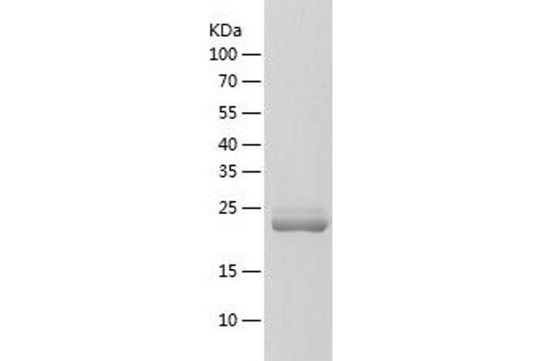 Frataxin Protein (FXN) (AA 1-210) (His tag)