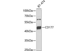 Western blot analysis of extracts of BT-474 cells, using CD177 antibody (ABIN6131282, ABIN6138125, ABIN6138127 and ABIN6222217) at 1:1000 dilution. (CD177 Antikörper  (AA 35-285))
