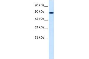 WB Suggested Anti-DACH2 Antibody Titration:  0. (DACH2 Antikörper  (C-Term))