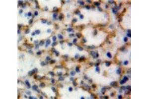 Used in DAB staining on fromalin fixed paraffin-embedded Spleen tissue