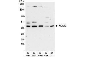 Western Blotting (WB) image for anti-Acetyl-CoA Acetyltransferase 2 (ACAT2) (AA 150-200) antibody (ABIN7454576)