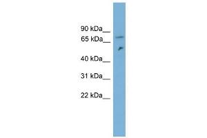 DYNC1I2 antibody used at 1 ug/ml to detect target protein.