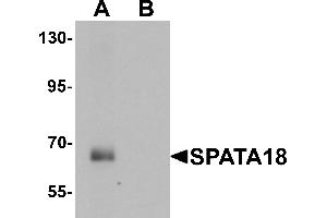Western blot analysis of SPATA18 in rat lung tissue lysate with SPATA18 antibody at 1 µg/mL in (A) the absence and (B) the presence of blocking peptide (SPATA18 Antikörper  (N-Term))