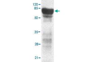 Western blot analysis of PHF2 monoclonal antibody  at 1 : 2000 dilution interacts with recombinant PHF2 protein with a GST tag. (PHF2 Antikörper  (C-Term))