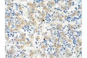 EXOSC6 antibody was used for immunohistochemistry at a concentration of 4-8 ug/ml to stain Hepatocytes (arrows) in Human Liver. (EXOSC6 Antikörper  (N-Term))