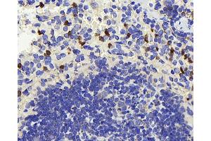 Immunohistochemistry (Paraffin-embedded Sections) (IHC (p)) image for anti-TSC22 Domain Family, Member 3 (TSC22D3) antibody (ABIN7249634)