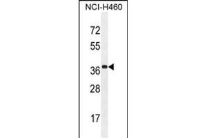 ZC3H15 Antibody (C-term) (ABIN654819 and ABIN2844492) western blot analysis in NCI- cell line lysates (35 μg/lane). (ZC3H15 Antikörper  (C-Term))