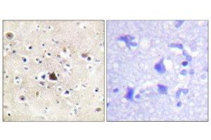 Immunohistochemistry (IHC) image for anti-GR (Internal Region), (pSer234), (Ser226), (Ser246) antibody (ABIN1847938) (GR (Internal Region), (pSer234), (Ser226), (Ser246) Antikörper)
