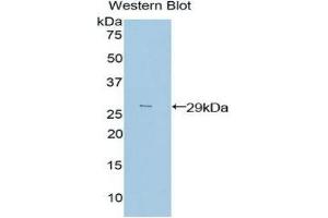 Western Blotting (WB) image for anti-Proto-Oncogene Pim-2 (Serine Threonine Kinase) (PIM2) (AA 98-319) antibody (ABIN1860222)
