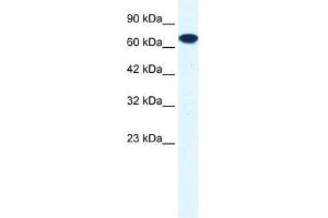 Human HepG2; WB Suggested Anti-ZNF179 Antibody Titration: 0. (RNF112 Antikörper  (C-Term))