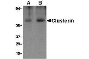 Western blot analysis of Clusterin in human brain tissue lysate with AP30239PU-N Clusterin body at (A) 0. (Clusterin Antikörper  (Isoform 1))