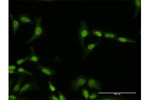 Immunofluorescence of purified MaxPab antibody to PI4K2A on HeLa cell. (PI4K2A Antikörper  (AA 1-479))