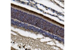 IHC analysis of PDE6 beta/PDE6B using anti-PDE6 beta/PDE6B antibody (ABIN7600892). (PDE6B Antikörper  (AA 25-237))