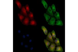 ABIN6257799 and ABIN6274834 staining  cells by IF/ICC. (AASS Antikörper  (C-Term))