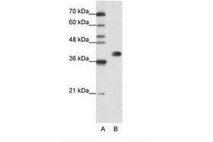Image no. 3 for anti-Heterogeneous Nuclear Ribonucleoprotein A3 (HNRNPA3) (N-Term) antibody (ABIN202382) (HNRNPA3 Antikörper  (N-Term))
