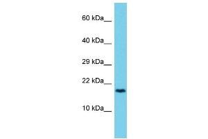 Host: Rabbit Target Name: CCDC12 Sample Type: 721_B Whole Cell lysates Antibody Dilution: 1. (CCDC12 Antikörper  (C-Term))