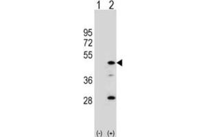 Western Blotting (WB) image for anti-Arylacetamide Deacetylase (Esterase) (AADAC) antibody (ABIN3002812) (AADAC Antikörper)