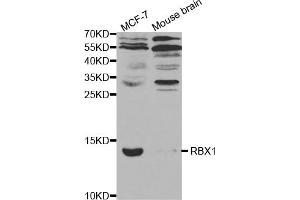 Western blot analysis of extracts of various cell lines, using RBX1 antibody. (RBX1 Antikörper)