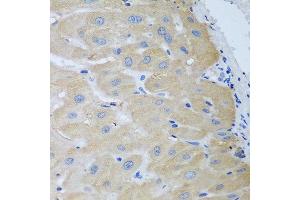 Immunohistochemistry of paraffin-embedded human liver using NME4 antibody at dilution of 1:100 (40x lens). (NME4 Antikörper)