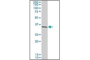 Western Blotting (WB) image for anti-SMAD, Mothers Against DPP Homolog 3 (SMAD3) antibody (ABIN781908) (SMAD3 Antikörper)