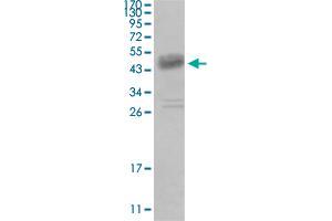 Western blot analysis of truncated DDR1 recombinant protein with DDR1 monoclonal antibody, clone 2G4E12 . (DDR1 Antikörper)