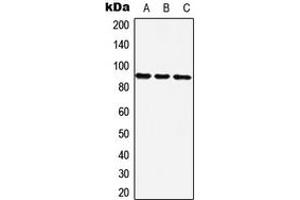 Western blot analysis of ZNF25 expression in Hela (A), NIH3T3 (B), H9C2 (C) whole cell lysates. (ZNF25 Antikörper  (C-Term))