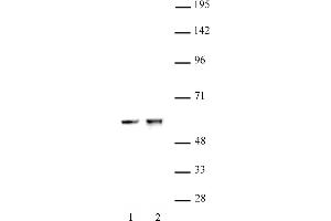 CDK8 antibody (pAb) tested by Western blot. (CDK8 Antikörper  (C-Term))