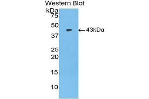 Western blot analysis of the recombinant protein. (BMP2 Antikörper  (AA 283-396))