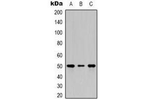 Western blot analysis of Beta2A-tubulin expression in Hela (A), NIH3T3 (B), rat kidney (C) whole cell lysates.