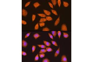 Immunofluorescence analysis of L929 cells using LY6E Rabbit pAb (ABIN6131998, ABIN6143391, ABIN6143392 and ABIN6214390) at dilution of 1:100 (40x lens). (LY6E Antikörper  (AA 21-101))