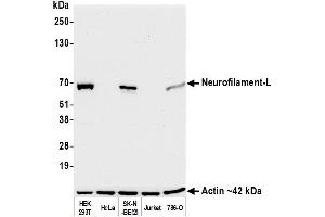 Western Blotting (WB) image for anti-Neurofilament, Light Polypeptide (NEFL) (AA 150-200) antibody (ABIN7453980) (Rekombinanter NEFL Antikörper  (AA 150-200))