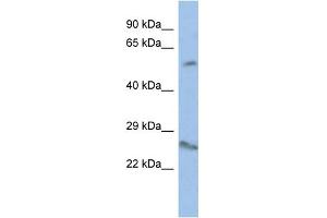 WB Suggested Anti-VENTX Antibody Titration:  0. (VENTX Antikörper  (Middle Region))