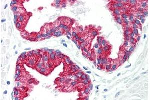 Human Prostate (formalin-fixed, paraffin-embedded) stained with KRT8 antibody ABIN292229 at 20 ug/ml followed by biotinylated anti-mouse IgG secondary antibody ABIN481714, alkaline phosphatase-streptavidin and chromogen. (KRT8 Antikörper)