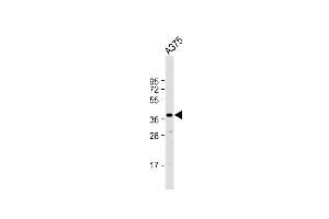Anti-PIH1D1 Antibody (Center) at 1:1000 dilution +  whole cell lysate Lysates/proteins at 20 μg per lane.