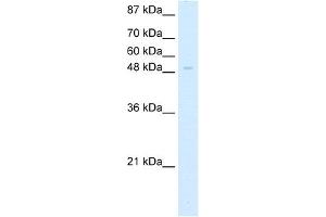 WB Suggested Anti-ZNF70 Antibody Titration:  5. (ZNF70 Antikörper  (C-Term))