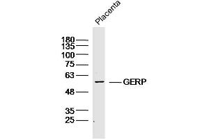 Mouse placenta lysates probed with GERP Polyclonal Antibody, Unconjugated  at 1:300 dilution and 4˚C overnight incubation. (TRIM8 Antikörper)