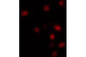 ABIN6274283 staining HuvEc cells by IF/ICC. (RBM5 Antikörper  (N-Term))