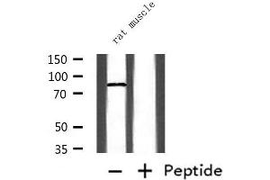 Western Blotting (WB) image for anti-CCCTC-Binding Factor (Zinc Finger Protein) (CTCF) (C-Term) antibody (ABIN6261079)
