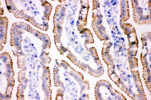 Immunohistochemistry (IHC) image for anti-Junction Plakoglobin (JUP) (AA 556-745) antibody (ABIN3043864)