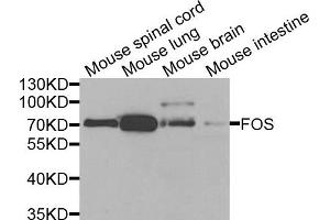 Western blot analysis of extracts of various cells, using FOS antibody. (c-FOS Antikörper)