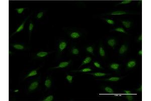Immunofluorescence of monoclonal antibody to ZNF256 on HeLa cell. (ZNF256 Antikörper  (AA 521-627))