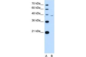 Western Blotting (WB) image for anti-SMAD, Mothers Against DPP Homolog 7 (SMAD7) antibody (ABIN2460354) (SMAD7 Antikörper)