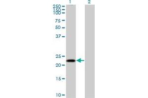 Western Blot analysis of MS4A4A expression in transfected 293T cell line by MS4A4A MaxPab polyclonal antibody. (MS4A4A Antikörper  (AA 1-239))