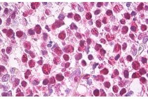 Anti-MCM5 antibody IHC staining of human tonsil. (MCM5 Antikörper)