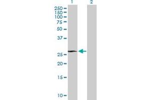 Western Blot analysis of RHOXF1 expression in transfected 293T cell line by RHOXF1 MaxPab polyclonal antibody. (RHOXF1 Antikörper  (AA 1-184))