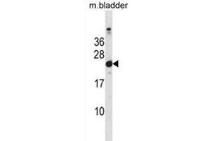 Mouse Hras1 Antibody (C-term) (ABIN1881438 and ABIN2838652) western blot analysis in mouse bladder tissue lysates (35 μg/lane). (HRAS Antikörper  (C-Term))