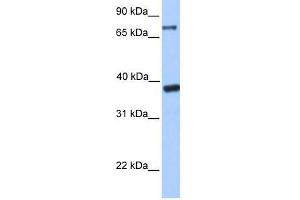 DIDO1 antibody used at 2. (DIDO1 Antikörper  (C-Term))